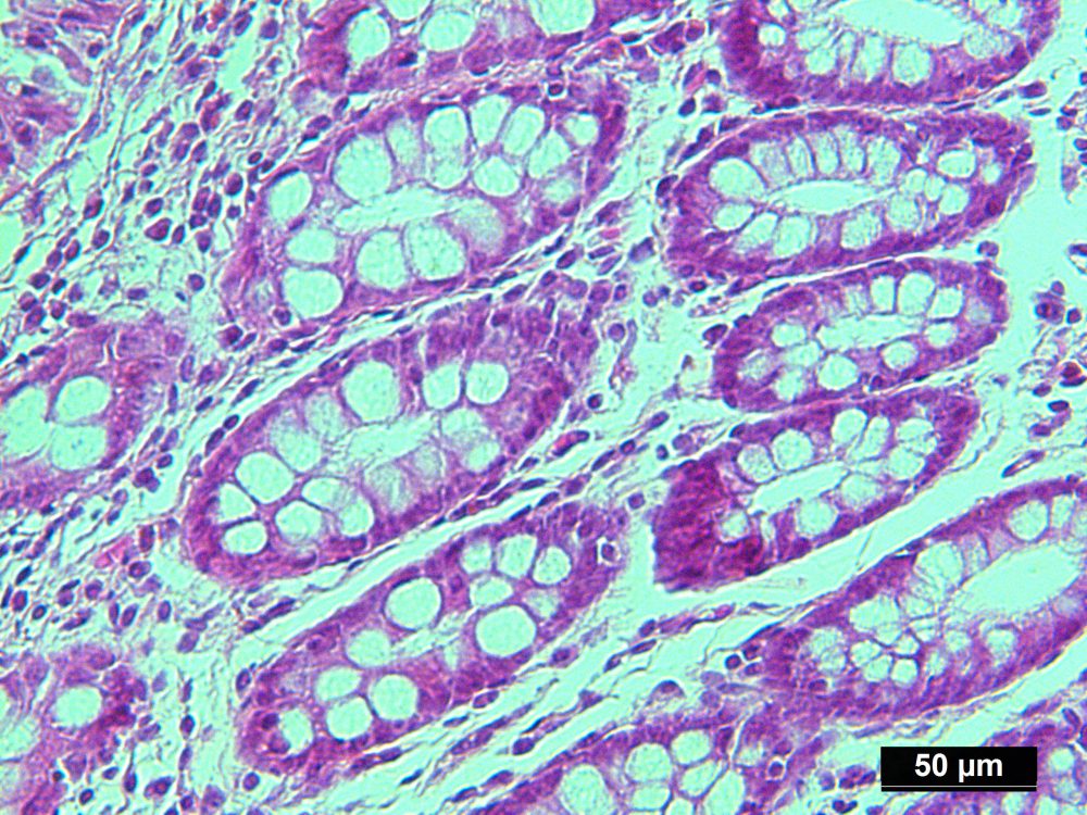 Protein Lysate of Pure Human Colon Normal Cells Isolated by LCM from ...