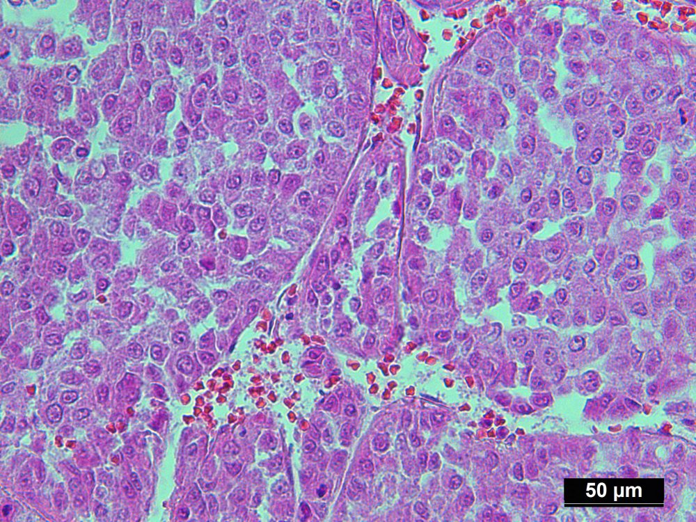 Genomic DNA Extracted from Pure Human Liver Cancer Cells Isolated by