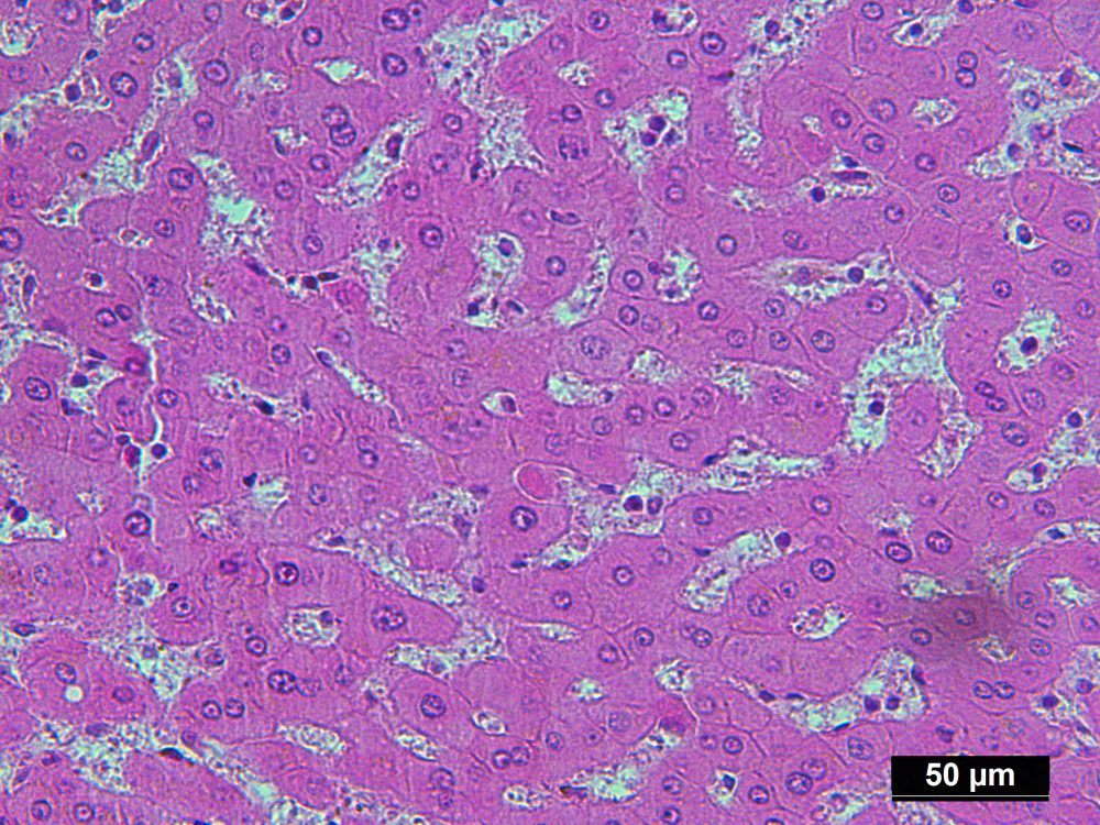 Pure Human Normal Hepatocytes Isolated by LCM from FFPE Sample