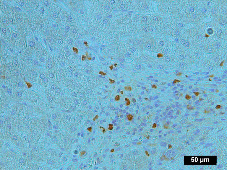 Genomic Dna Extracted From Pure Human Liver Cancer Cells Isolated By Lcm From Ffpe Sample 