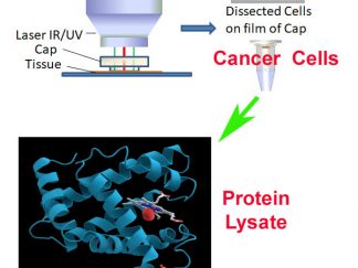 Protein from Pure Tumor Cell Population