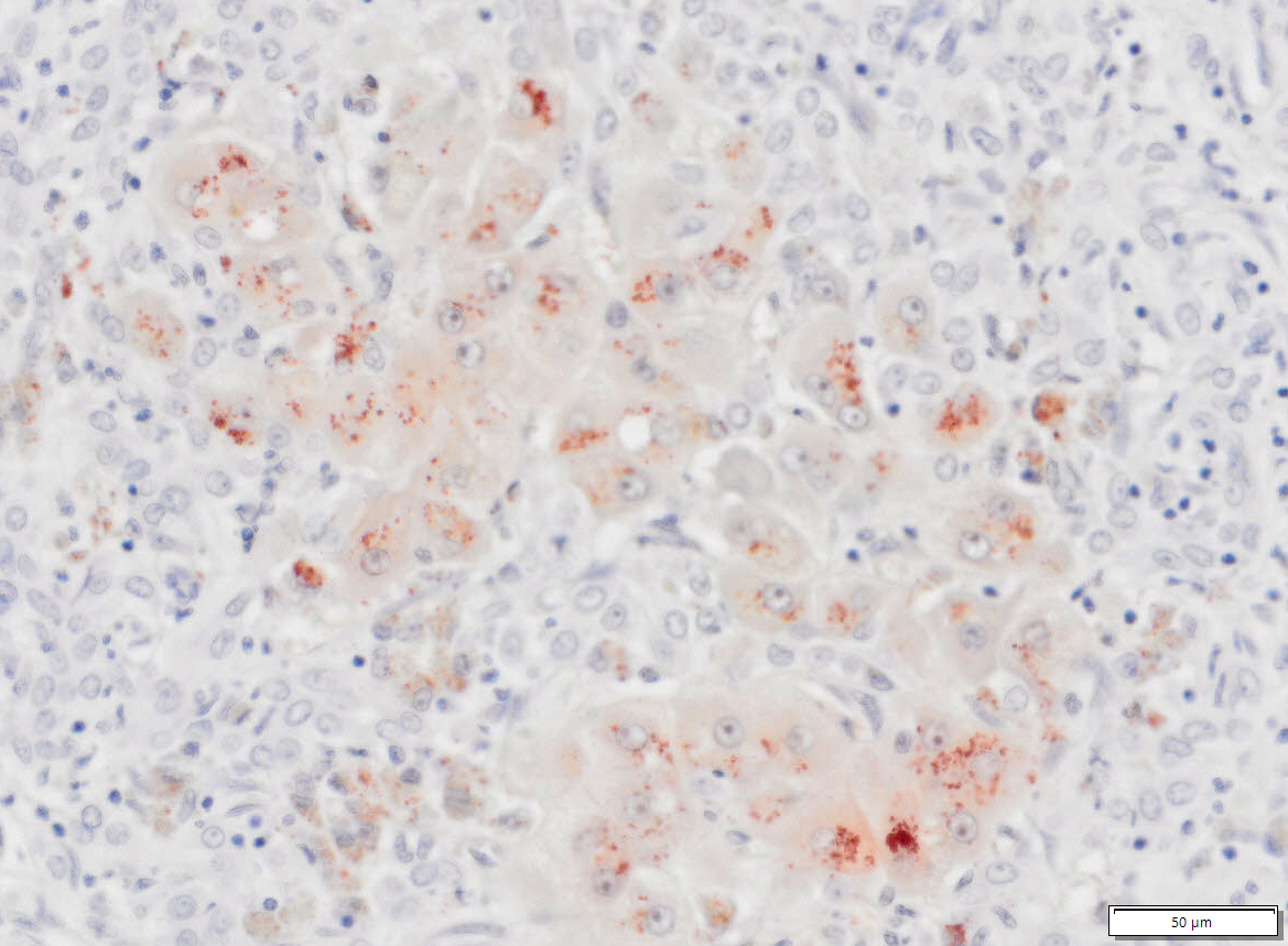 VitroView™ Rhodanine Copper Stain Kit