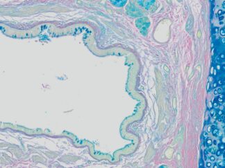VitroView™ Colloidal Iron Stain Kit