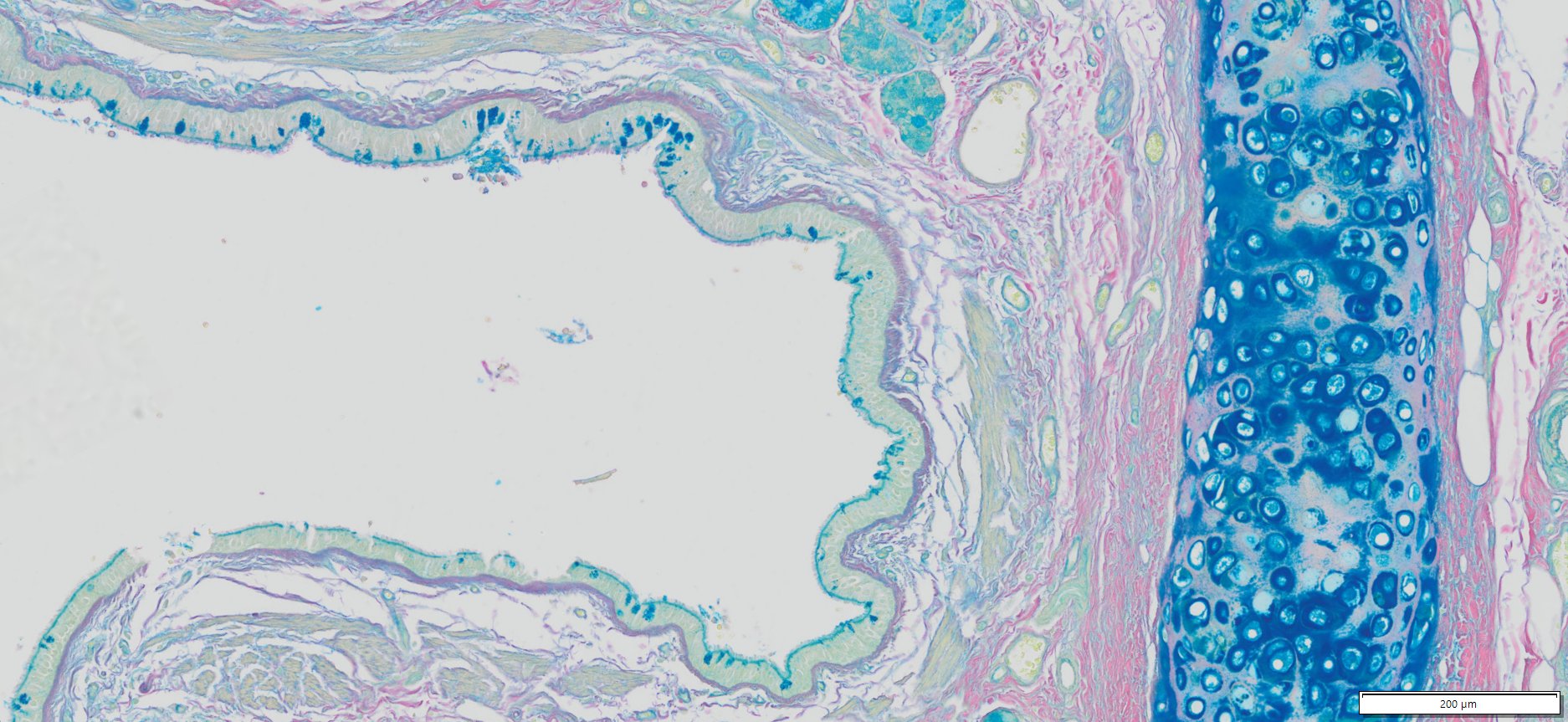 VitroView™ Colloidal Iron Stain Kit