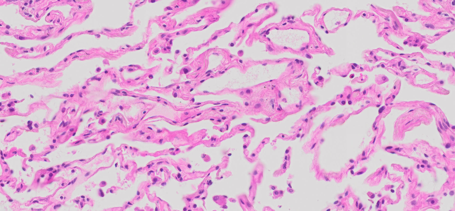 Human Lung Tissue Normal FFPE Sections