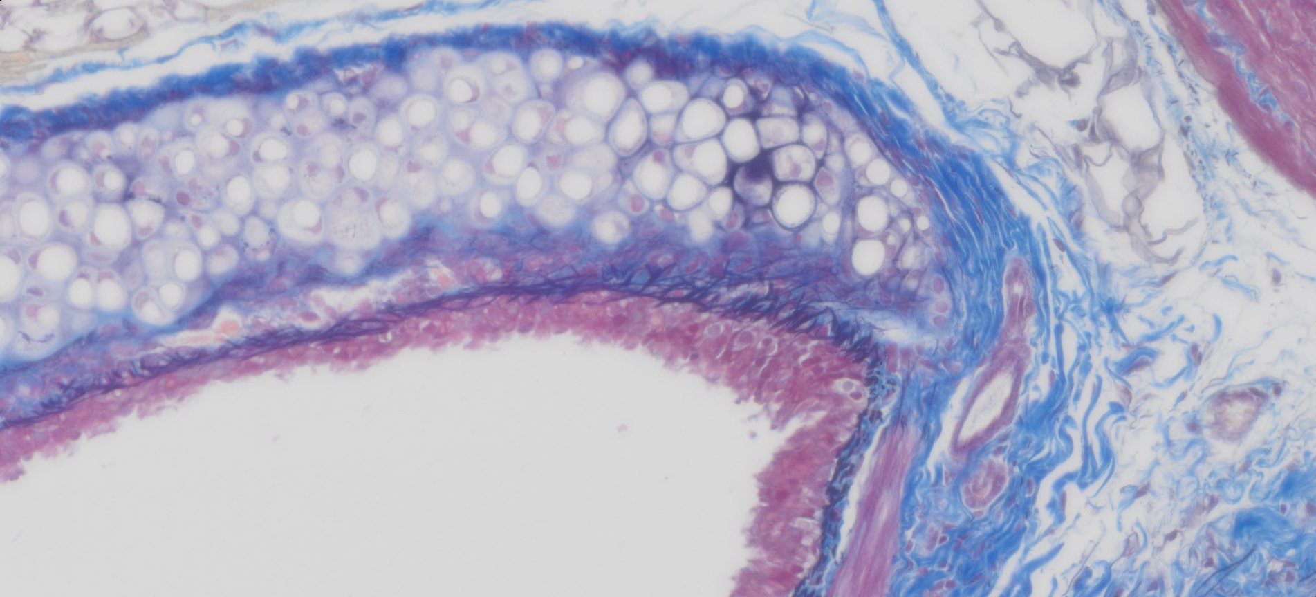 VitroView™ Verhoeff Elastic Masson Trichrome Stain Kit