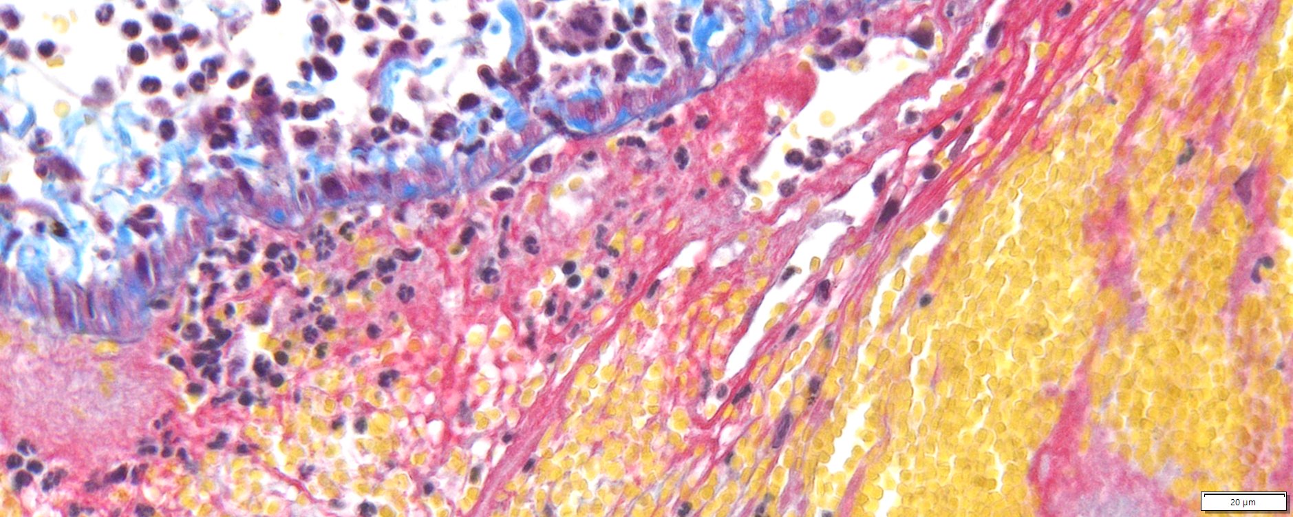 VitroView™ Martius Scarlet Blue (MSB) Stain Kit