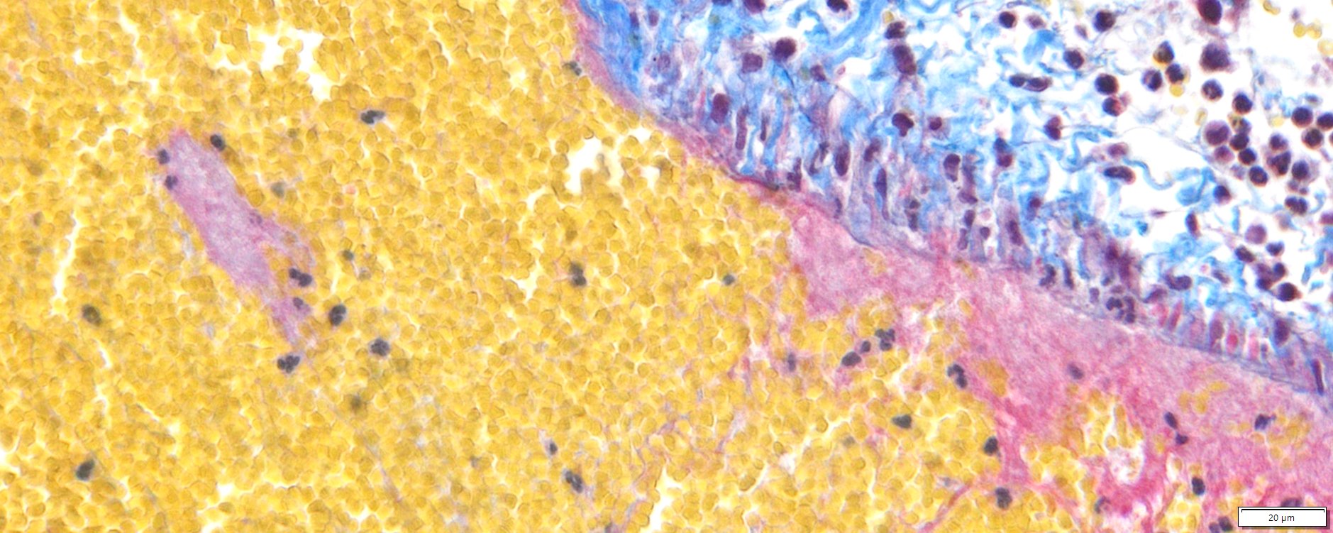 VitroView™ Martius Scarlet Blue (MSB) Stain Kit