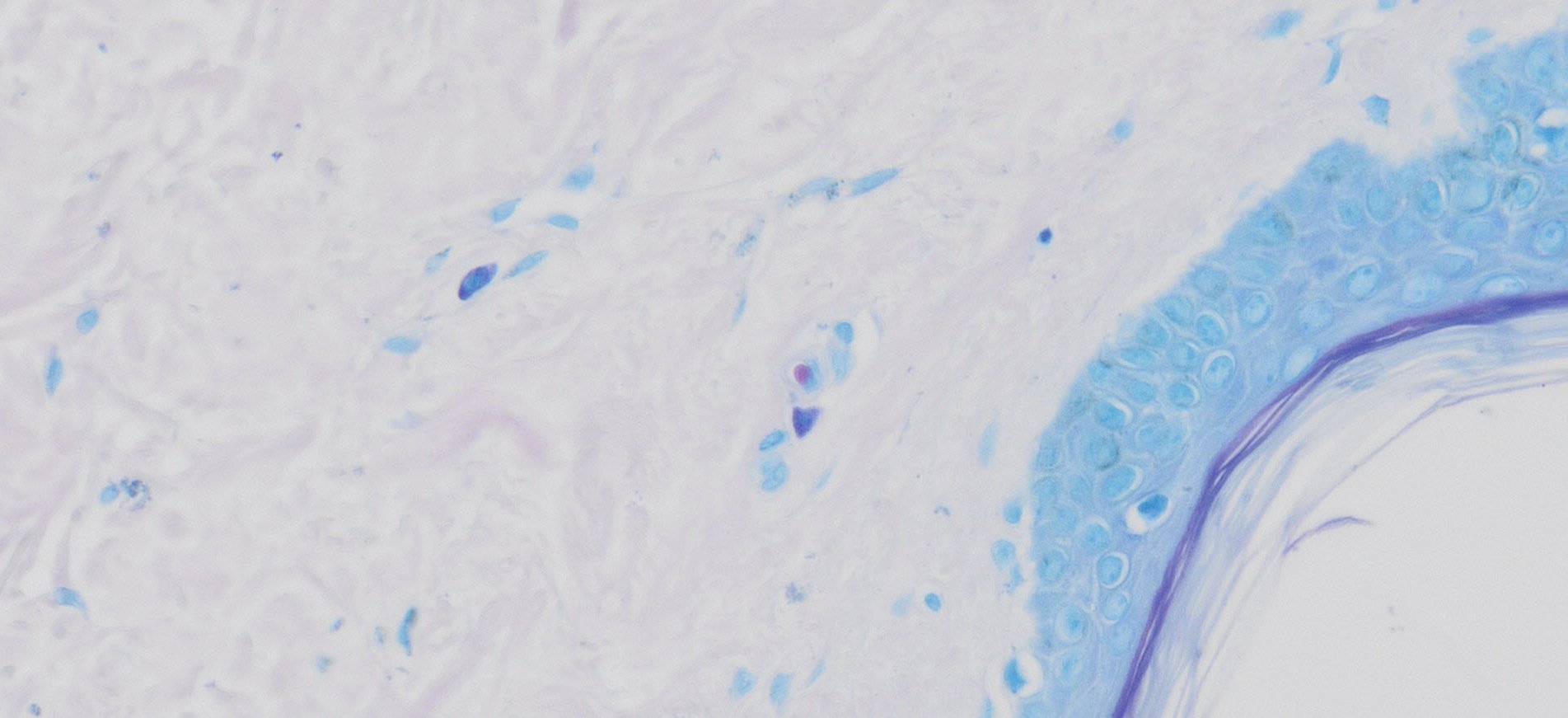 VitroView™ Giemsa Stain Kit