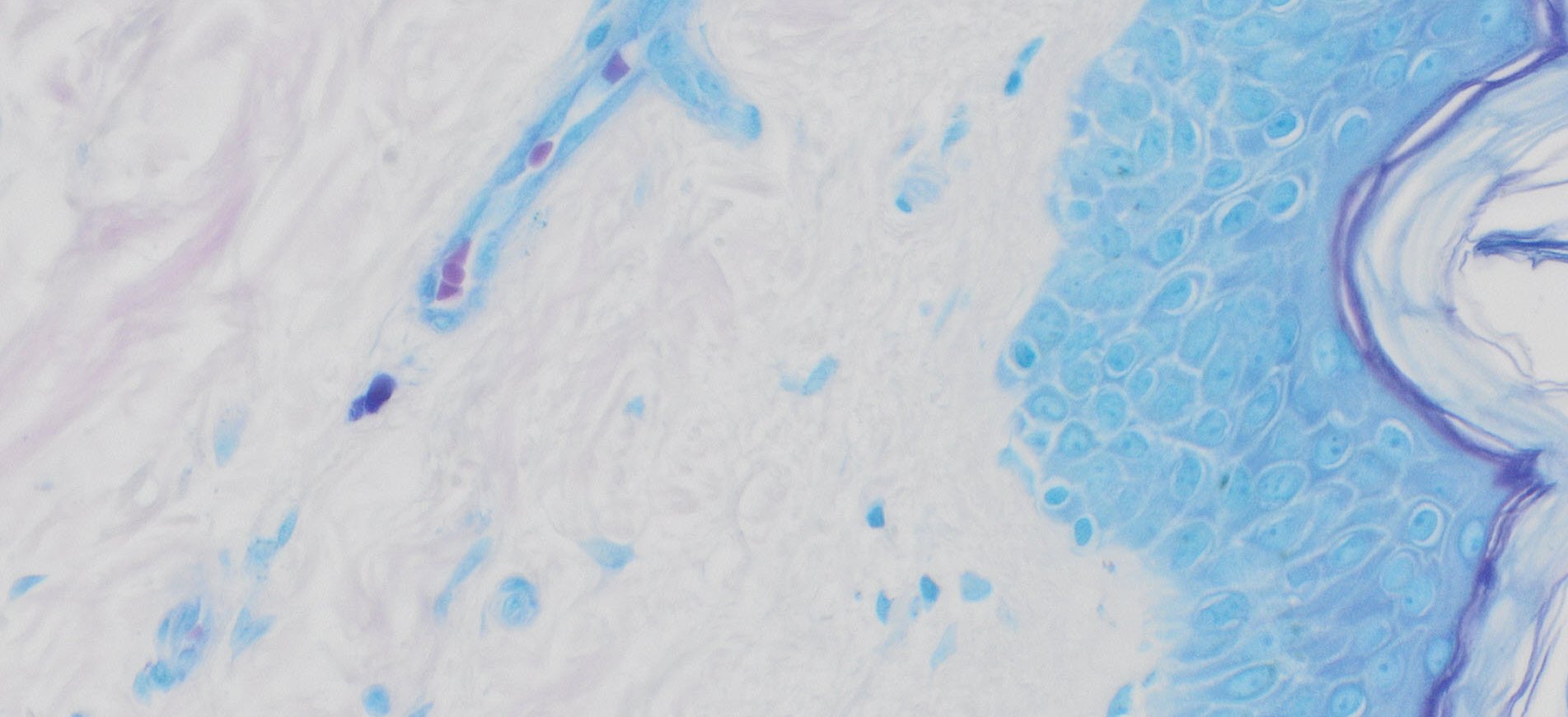 VitroView™ Giemsa Stain Kit