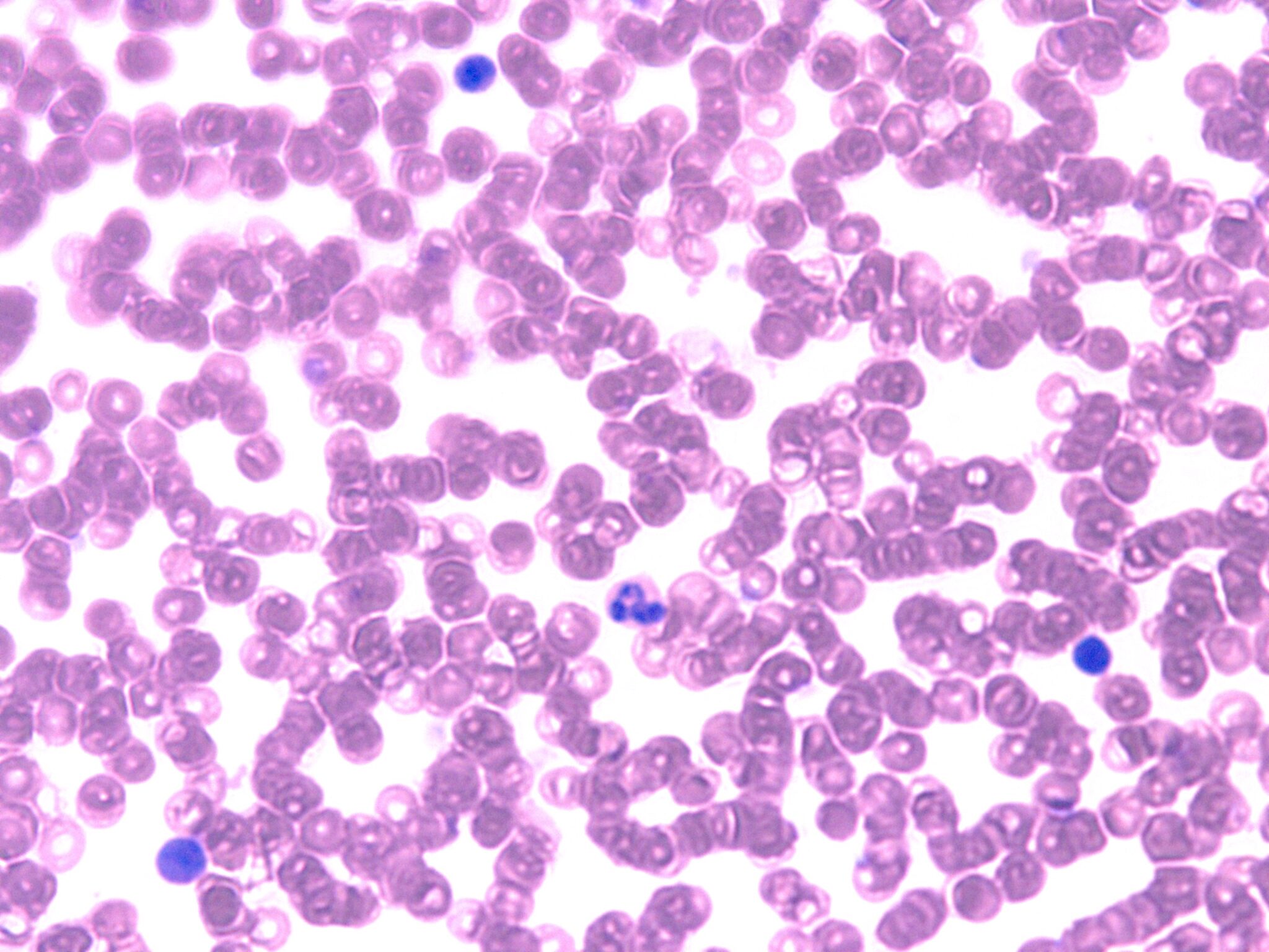 VitroView™ Giemsa Stain Kit