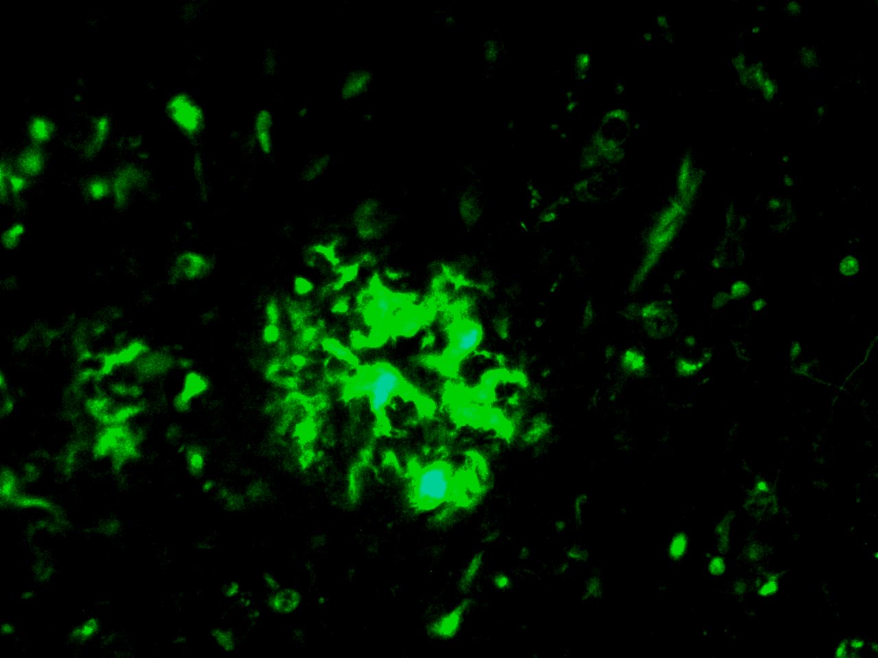VitroView Thioflavin S Stain Kit