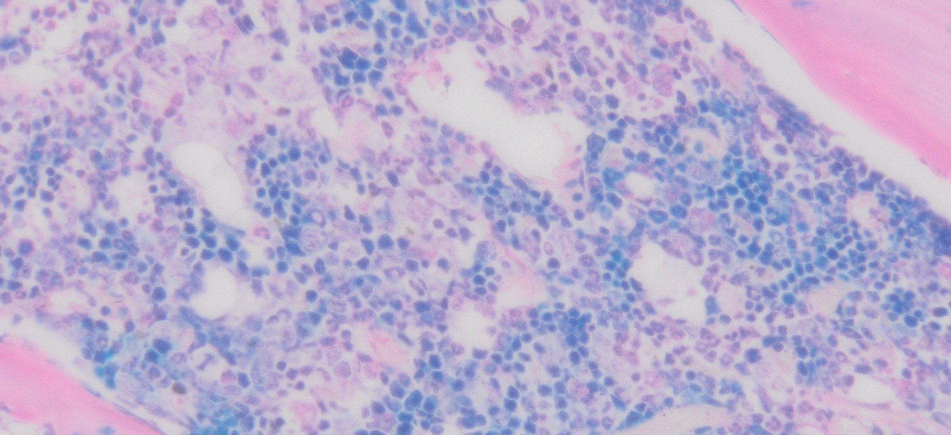 Differential Quik Stain Kit Modified Giemsa vrogue.co