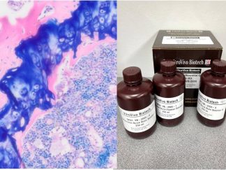VitroView™ Differential Quik Stain Kit