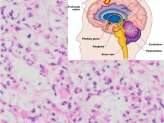 Human Brain Cancer FFPE Sections