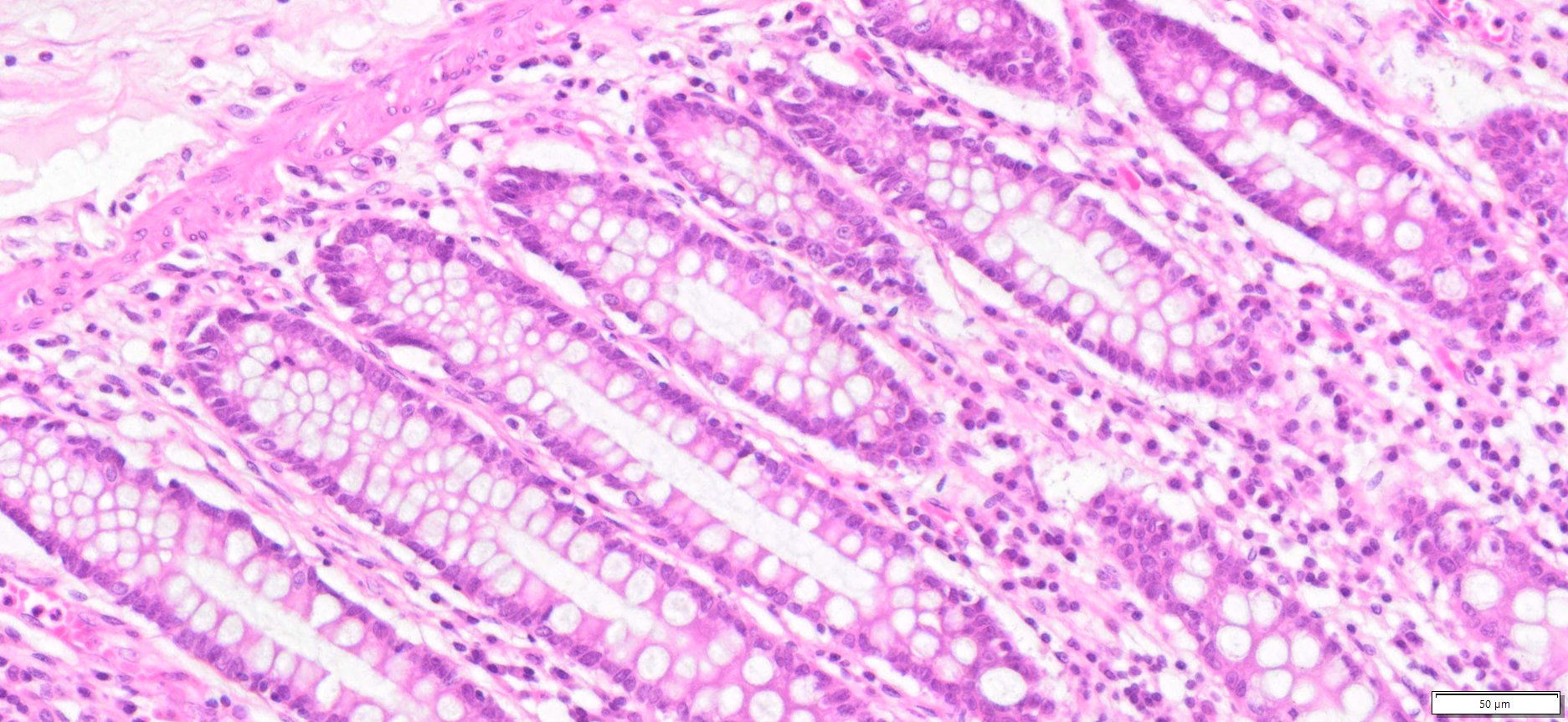 HuPS-07006A Human Colon (Normal), H&E, 20x