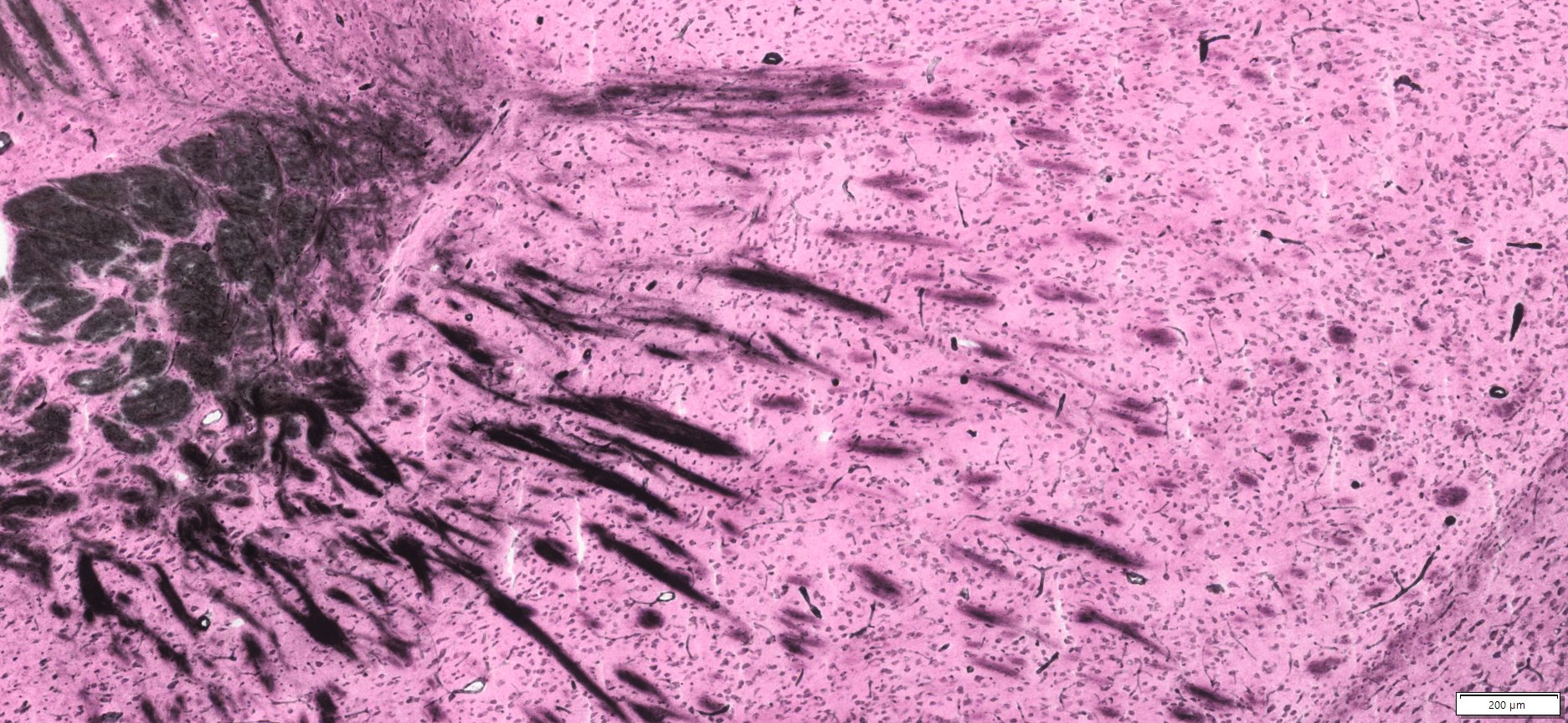 Gallyas Silver Staining, Mouse Striatum,,4x