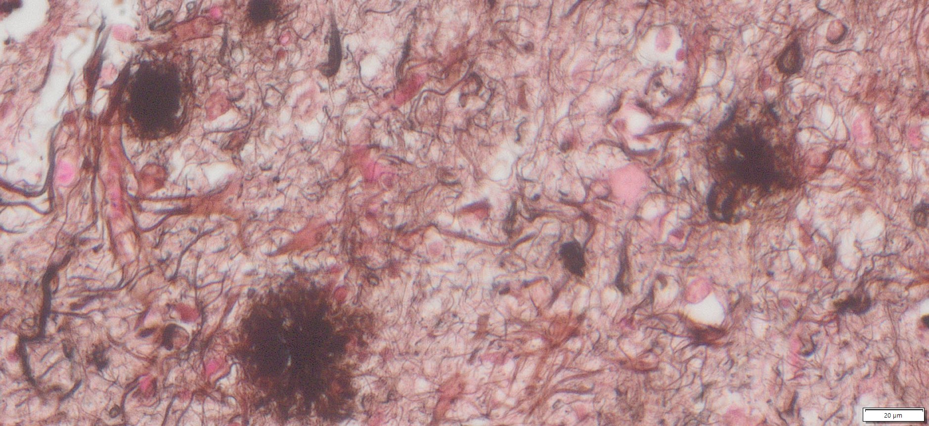 VitroView™ Gallyas Silver Stain Kit