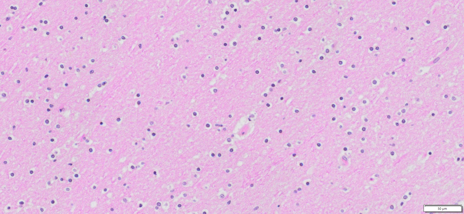 Human Brain FFPE Tissue Sections (Normal Cerebral Gray Matter and White ...