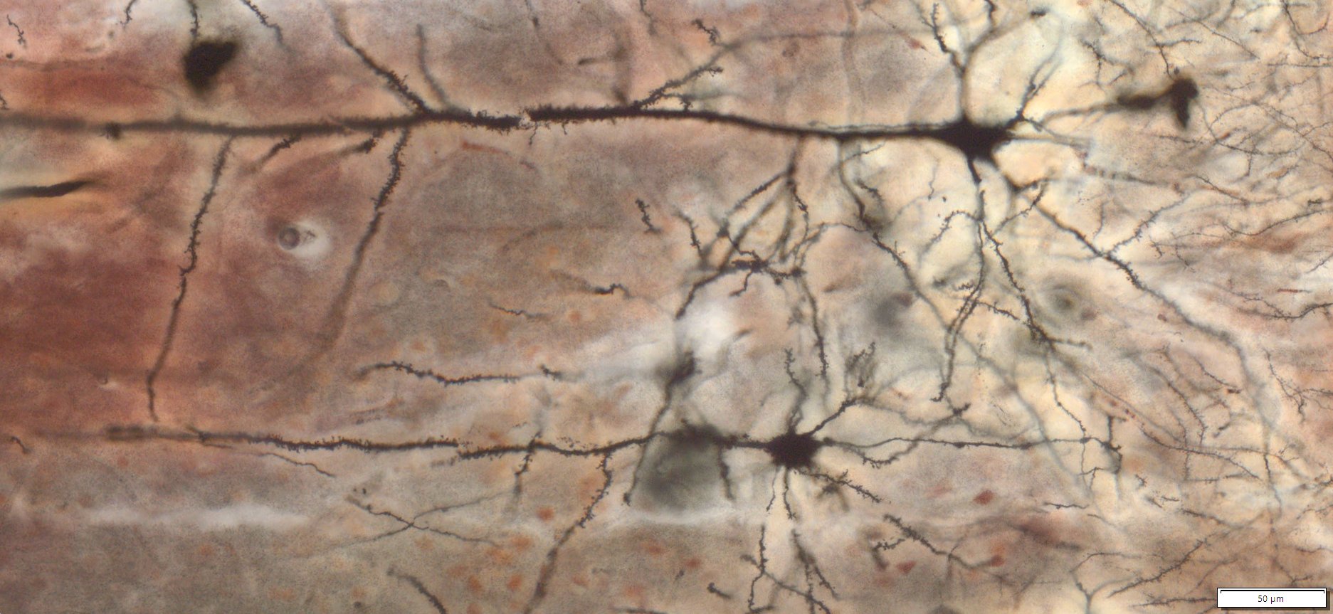 Mouse Brain Goldi-Cox Staining, 20x