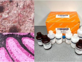 VitroView™ Gallyas Silver Stain Kit