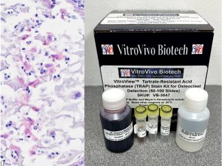 VitroView™ Tartrate-Resistant Acid Phosphatase (TRAP) Stain Kit for Osteoclast Detection (50-100 Slides)