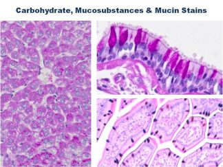 Carbohydrate, Mucosubstances & Mucin Stains