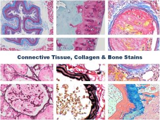 Special Stains for Connective Tissue, Collagen  & Bone