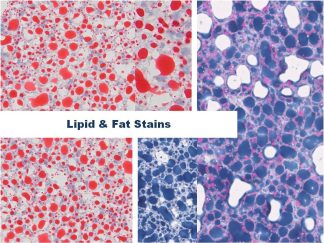 Lipid & Fat Stains