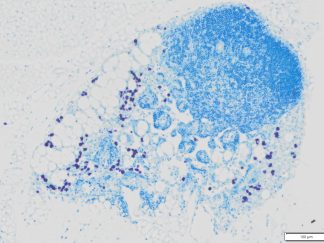 Histochemical Inflammation Cell Stains