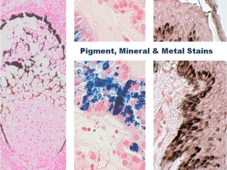 Pigment, Mineral & Metal Stains