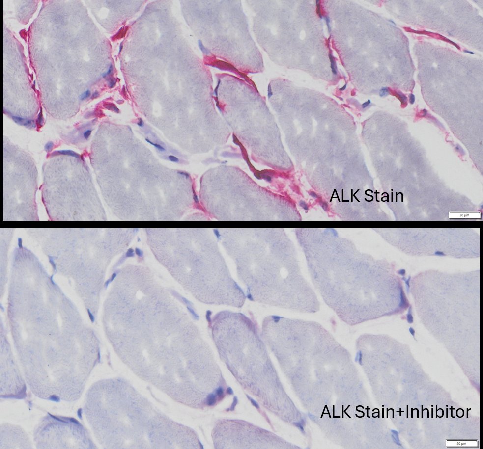 VitroView™ Endogenous Alkaline Phosphatase (ALP) Histochemical Stain Kit (50-100 Slides)