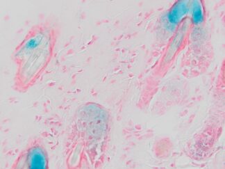 VitroView™ Senescence-Associated β-Galactosidase (SA-β-gal) Staining Kit (100-200 Tests)