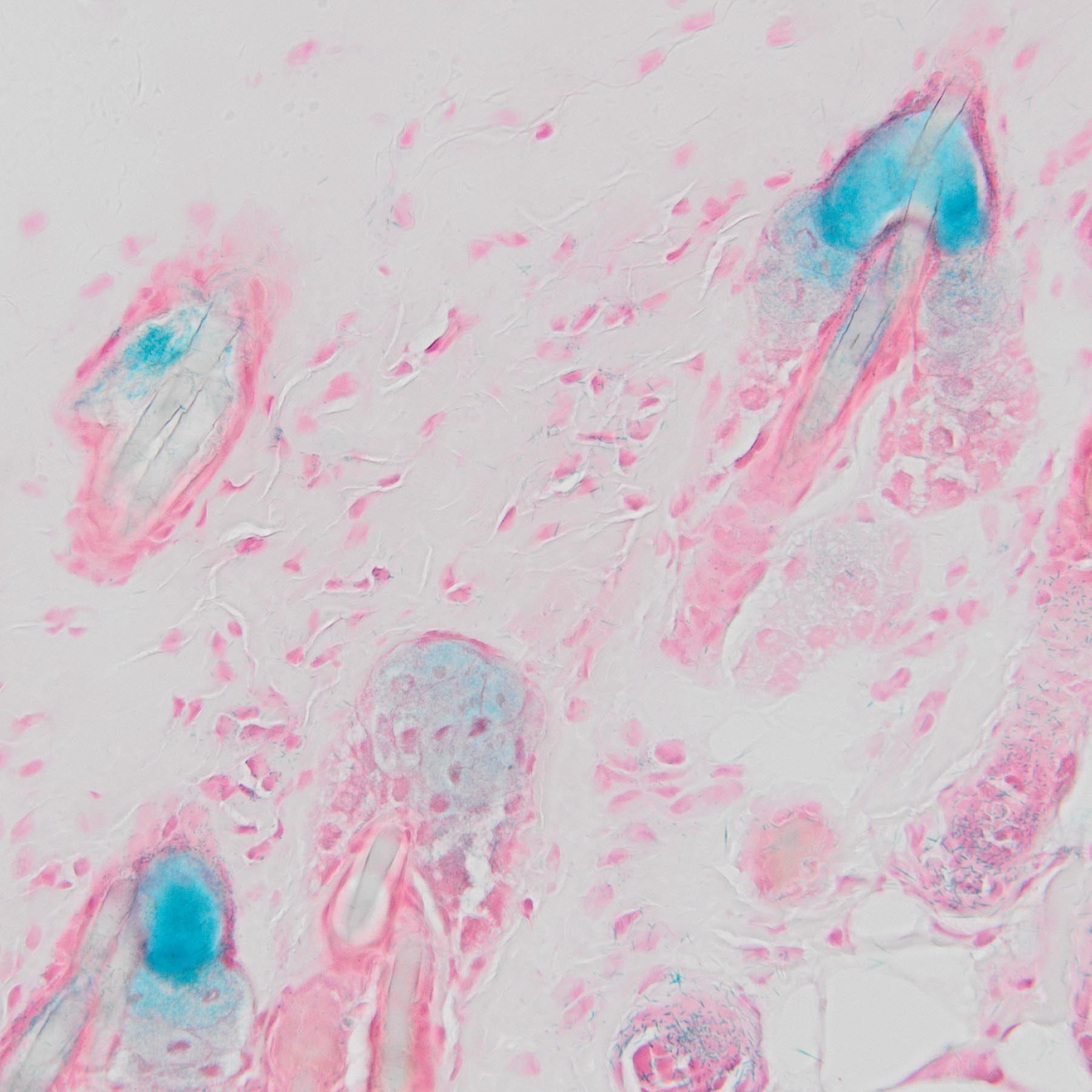 VitroView™ Senescence-Associated β-Galactosidase (SA-β-gal) Staining Kit (100-200 Tests)