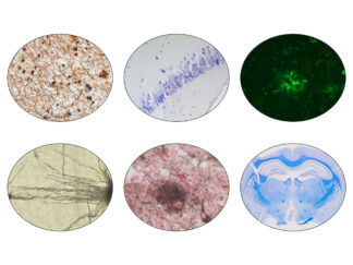 Neural & CNS-Related Stain kits