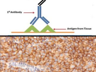 LSAB IHC Detection System