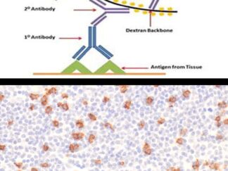 Polymer Based 1-Step IHC System