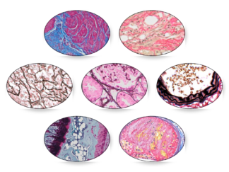 Connective Tissue, Collagen, Fibrin & Bone Stain Kits