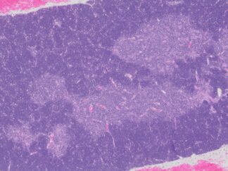 Mouse Thymus Tissue (Normal) Paraffin Sections (1 section/slide, 5 slides/package) (SKU# MsPS-C57M12mThymus)