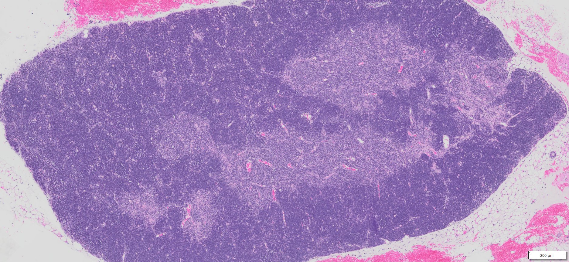 Mouse Thymus Tissue (Normal) Paraffin Sections (1 section/slide, 5 slides/package) (SKU# MsPS-C57M12mThymus)
