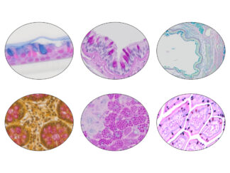Carbohydrate, Mucosubstances & Mucin Stain Kits