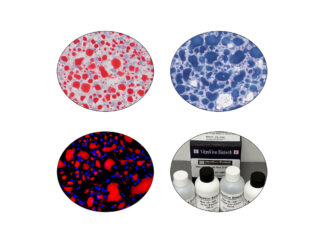 Lipid & Fat Stain Kits